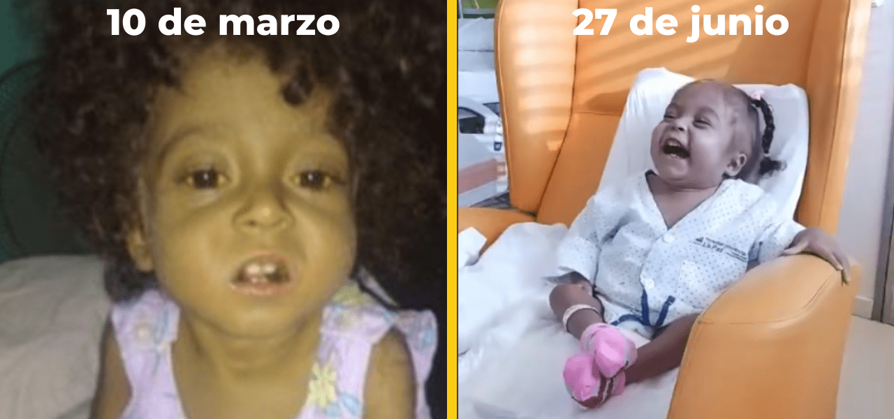 Milagro en España: la niña cubana Amanda es felicidad hecha vida